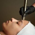 Dermapen Facial 1h
